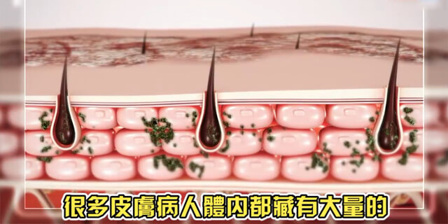 百癬膏,BJXTW